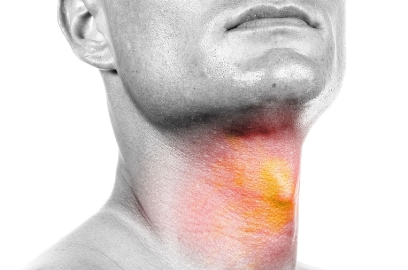 بروز سرطان های سر و گردن در مردان